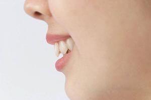 長引く腰痛を整体院の施術で解消